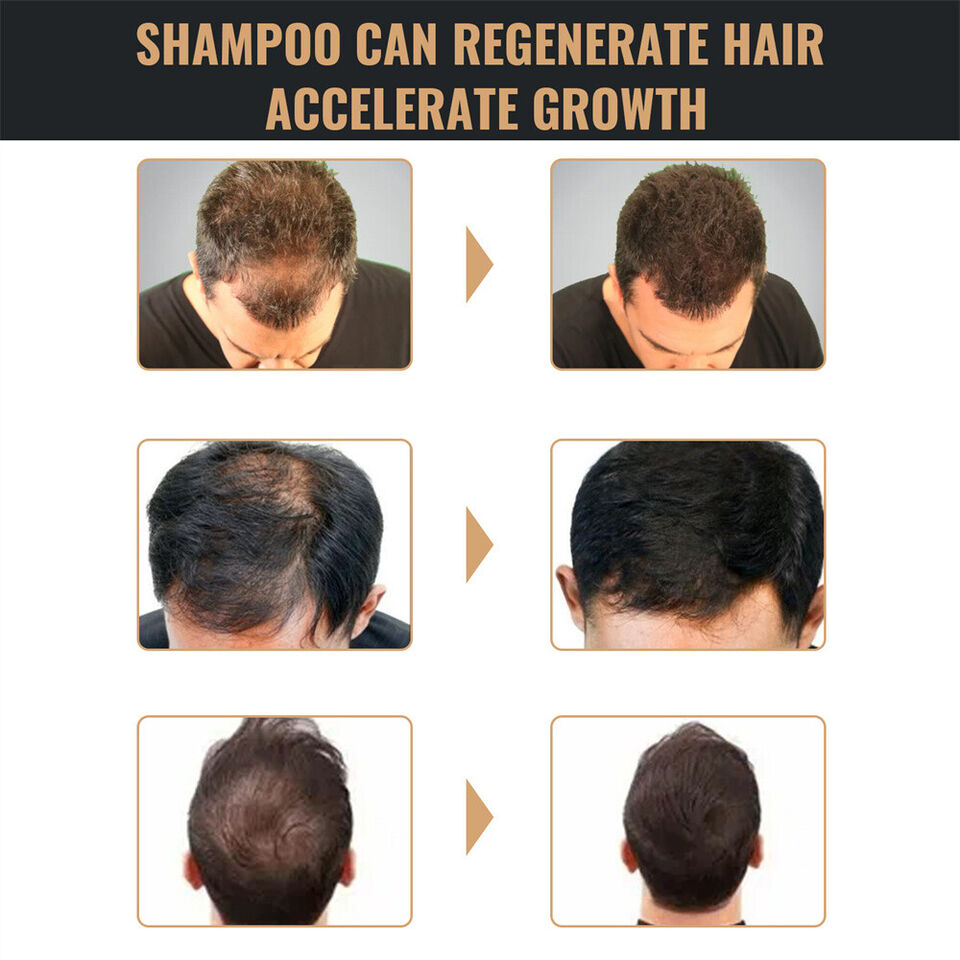 Spartan Shampoo, Spartan Root Activator Shampoo, Natural Hair Regrōwth Shampoos